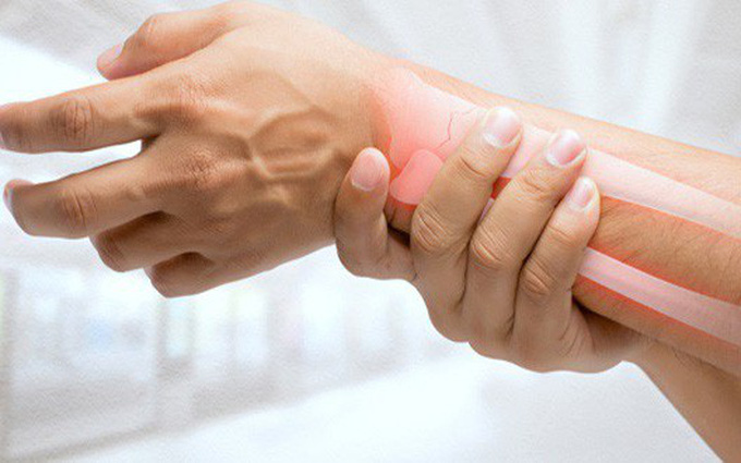 Gần 50% dân số trên 50 tuổi tại TPHCM cần điều trị loãng xương