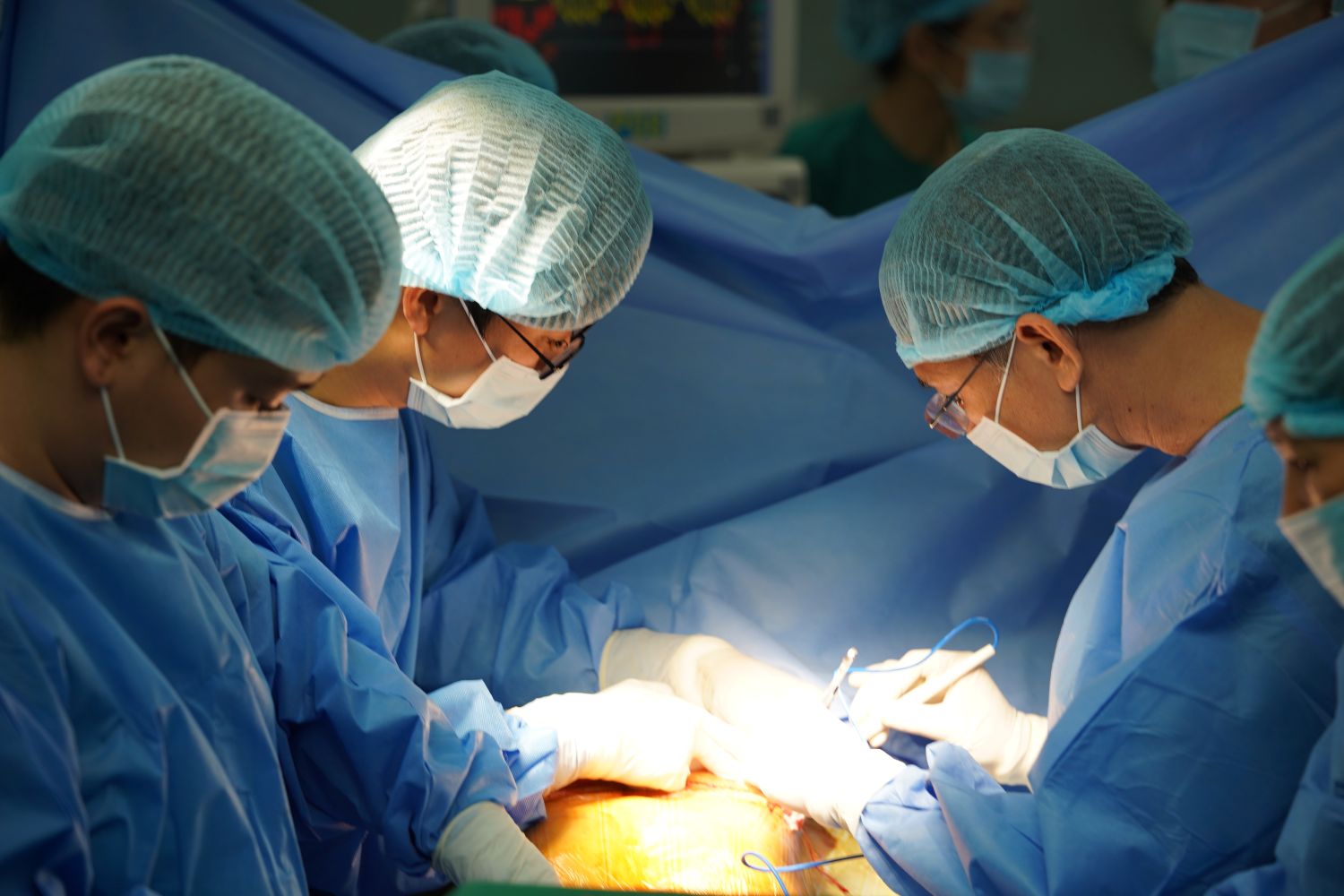 Bệnh viện Chợ Rẫy và hành trình ghép tạng thành công cho 7 bệnh nhân- Ảnh 3.