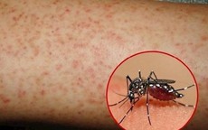 Dịch sốt xuất huyết gia tăng, TPHCM kêu gọi người dân nâng cao ý thức phòng bệnh