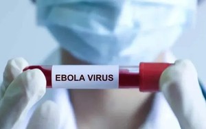 Sở Y tế TPHCM chủ động giám sát, ngăn nguy cơ dịch Ebola xâm nhập